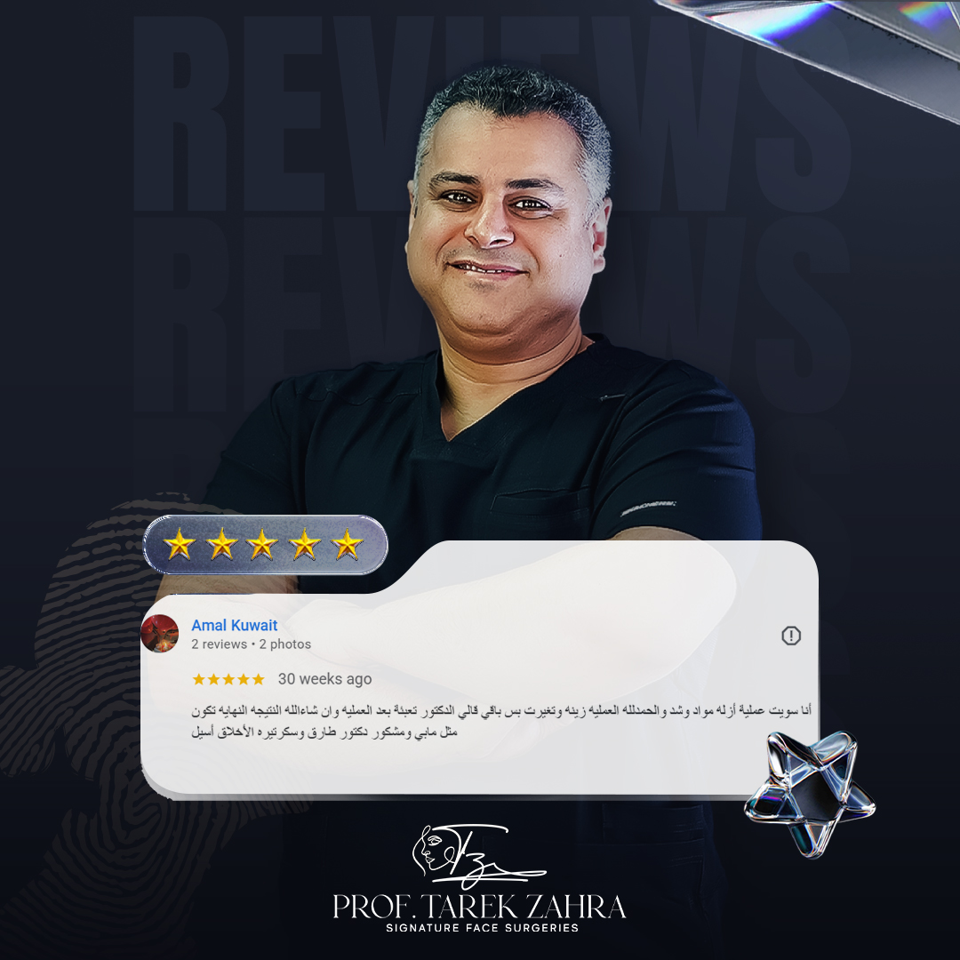 اراء العملاء